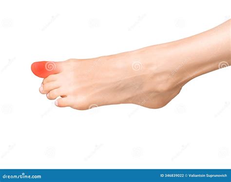 Big Toe Pain, Joint Ache, and Inflammation. Sore Foot with Sprain, Tendon Bruise, and Calcaneal ...