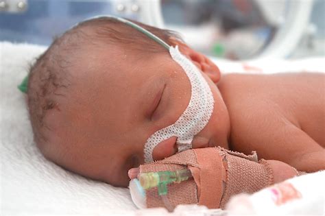 NICU Resuscitation, Oxygen Therapy, and Aerosol Delivery | RT