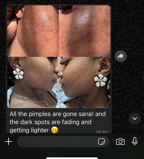 Bare in Mind these results are less than a month🥲 Don’t sleep on my s ...