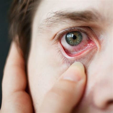 Spiritual meaning of broken blood vessel in EYE - Awakening State