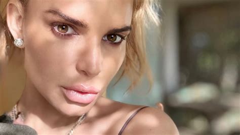 What Happened to Jessica Simpson's Face? Actress Gets 'Botched Plastic Surgery' for All's Fair ...