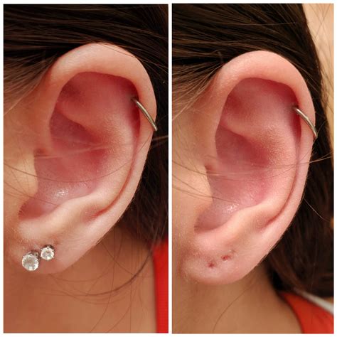 Ear Lobe Holes Earrings Too Big For Hole In Ear Online