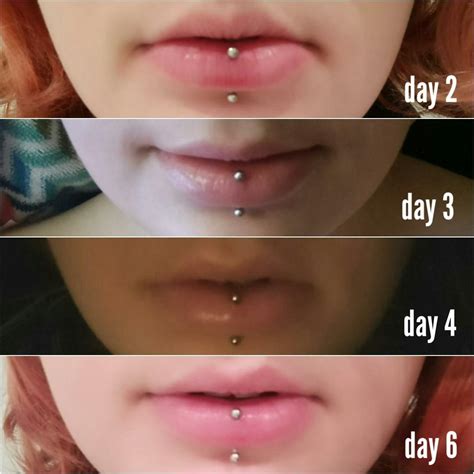 Top 90+ Pictures Nose Piercing Healing Stages With Pictures Completed