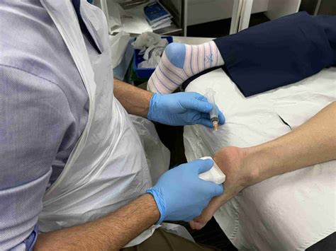 Plantar Fasciitis | Cortisone injections | Joint Injections