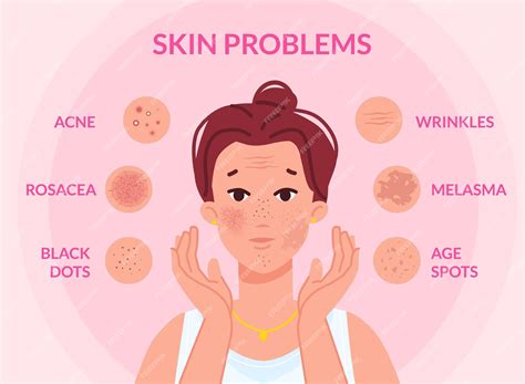 Premium Vector | Types skin problems woman face with skins troubles melasma pimple blemishes ...