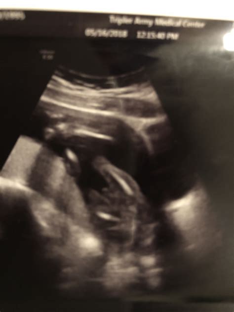 32 Weeks Pregnant Ultrasound Boy