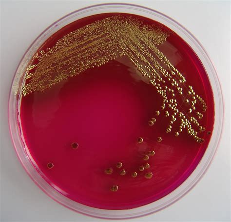 E Coli