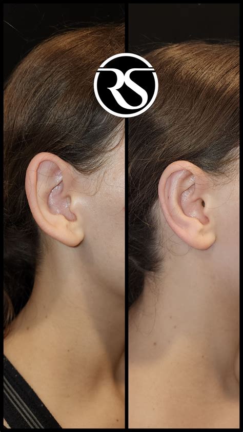 Face | Reshape Plastic Surgery