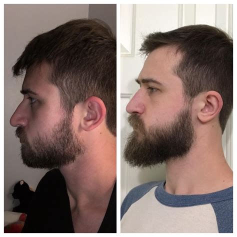 How To Trim Beard Chin Line at Tyson Walsh blog