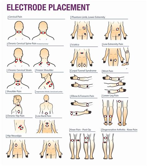 Electrode Pad Placement Chart Elegant Tens Unit Pads Google Search ...