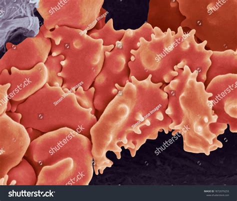 1 Osmotic Shrinkage Images, Stock Photos & Vectors | Shutterstock