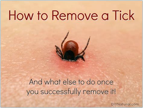 How to Remove A Tick: And What to Do Once You've Been Bitten | Get rid ...