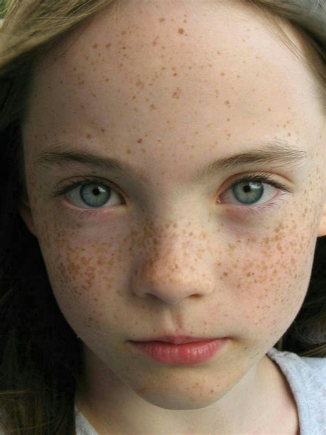 Pin on Freckles