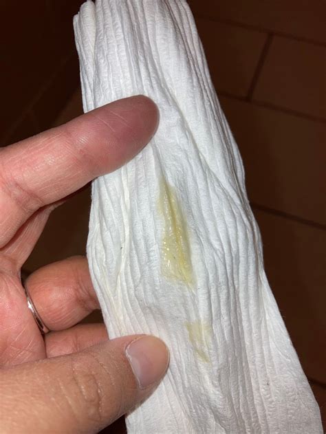 Pregnancy Discharge Color