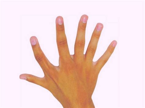 Meanings of Birthmark in Eye [Right or Left Eye Freckle] | What Spiritual