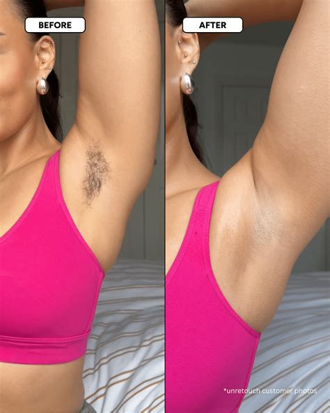 Bye Bye Bush | Remove Unwanted Hairs Without Shaving – Oyo Skincare