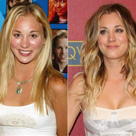 Kaley Cuoco Talks About Getting Breast Implants | Bizrahmed