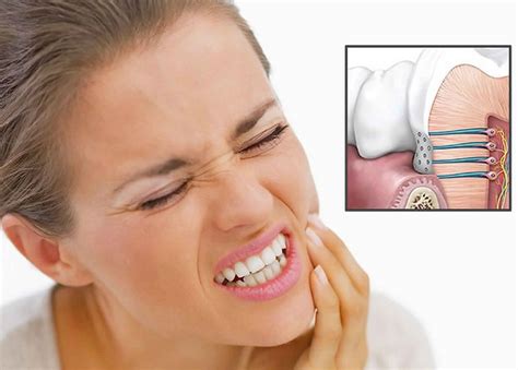 What Causes Severe Sensitive Teeth at Ken Darbonne blog