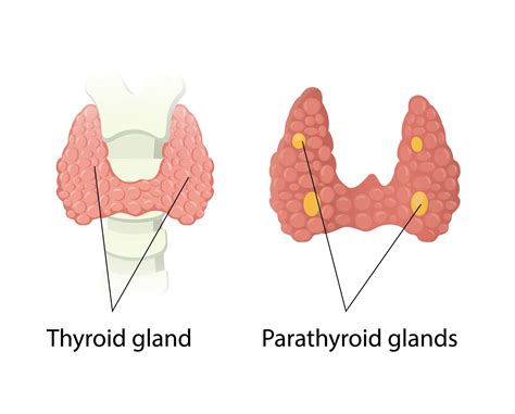 Hyperparathyroidism vs. Hyperthyroidism: Signs, Causes