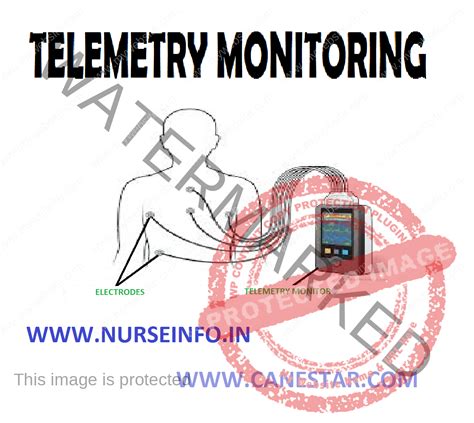 TELEMETRY MONITORING - Nurse Info