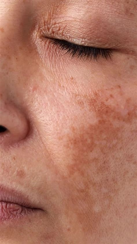 8 Common Skin Problems and How to Fix Them | Skin problems, Spots on face, Skin patches