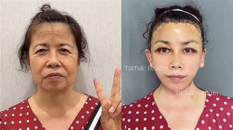 Video del cirujano de TikTok: ¿quién es el Dr. Kim?