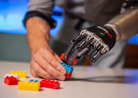 Electric Vs. Body-Powered Prosthetic Arms - TRLP