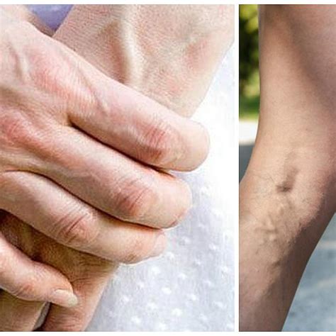 Tus Venas En El Brazo