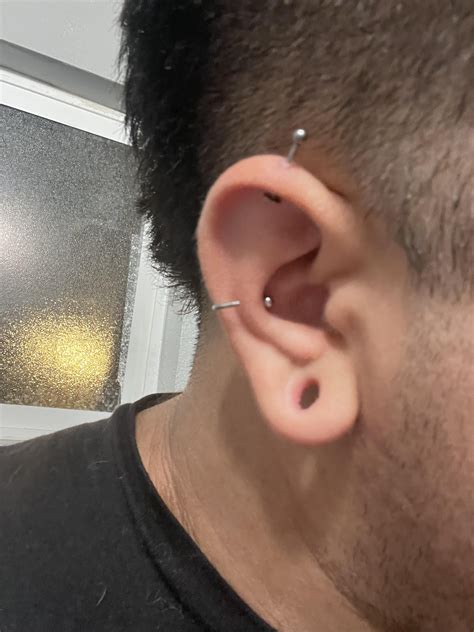 Cysts inside lobe?? : r/Stretched