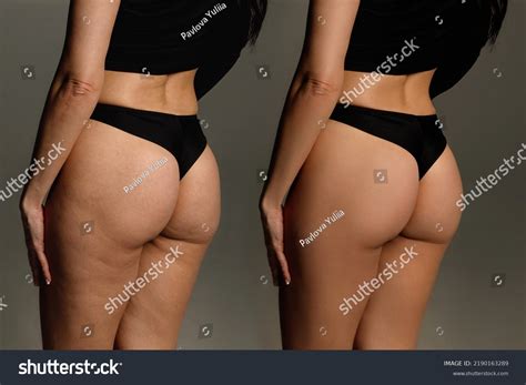 10,573 Body Weight Before After Images, Stock Photos & Vectors | Shutterstock