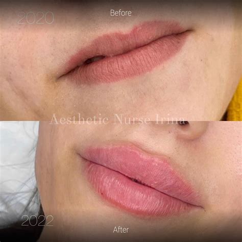 Cosmetic Treatments Before and After Gallery