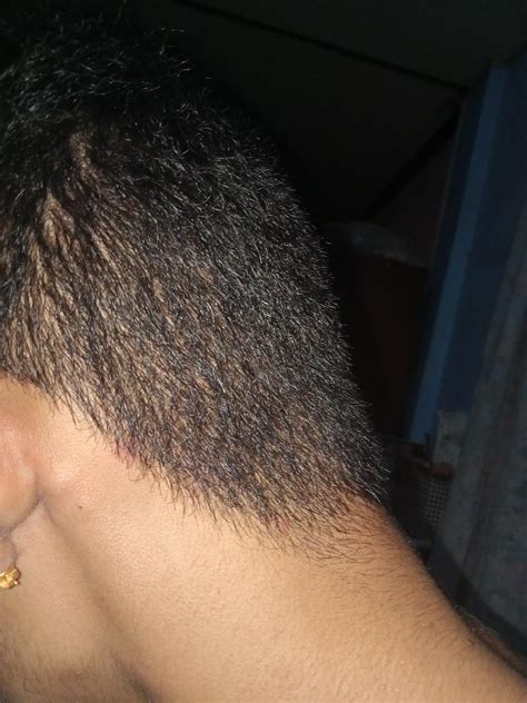 Cancerous Lumps Behind Ear