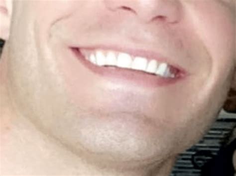 Suffering from gram negative folliculitis? Here is what helped me : r ...