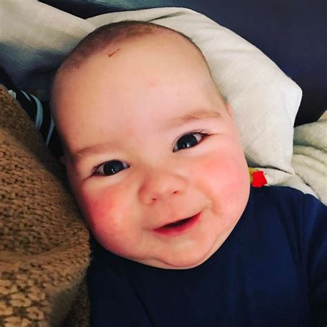 Red Cheeks From Teething at Doris Whitfield blog