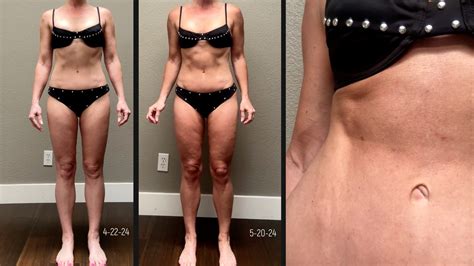 Melanotan 1 vs. 2: My Summer Journey & Real Results - Natural Kaos