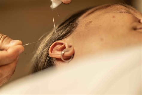 Fall Allergies in Naples: Natural Relief with Acupuncture - I Am ...