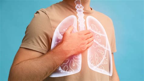 La Bronquitis Es Peligrosa