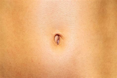 What Is Yellow Discharge From Belly Button at Samantha Sternberg blog