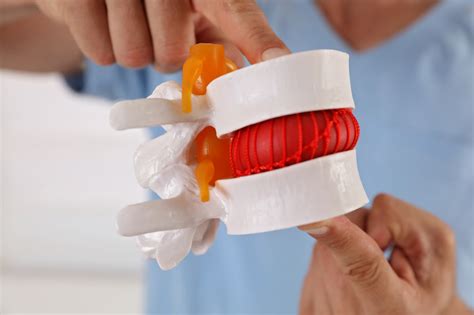 Advanced Spinal Decompression Chiropractor | PostureWorks Chiropractic