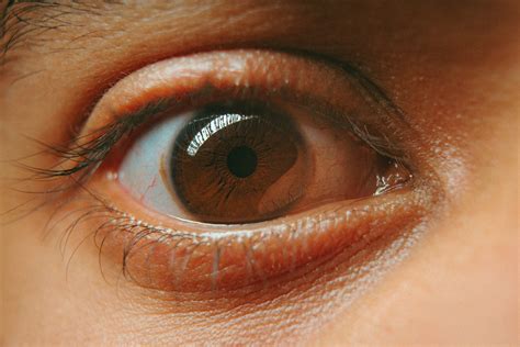 Corneal Ulcers: Causes, Prevention, and Recovery