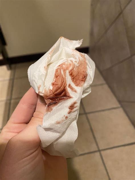 Ovulation Spotting Brown