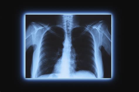 X-Ray Imaging Radiography : Radiographic positioning terminology – MNPUN