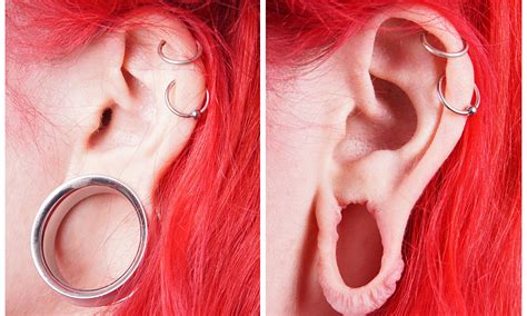Earlobe Repair, Surgery for Stretched or Split Ear Lobes | Earlobes ...