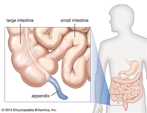 Where Is Your Appendix Located