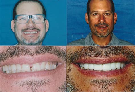 Dental Professionals Of Lincoln Park at Anna Beyers blog