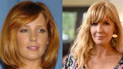 Exploring Kelly Reilly Plastic Surgery: Truth Behind The Transformation