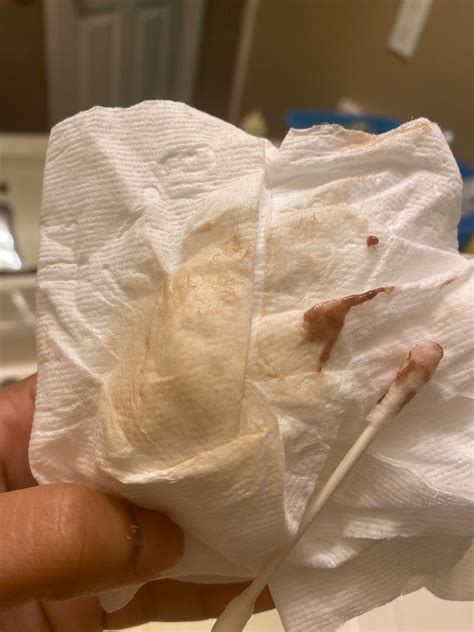 Light Brown Discharge During Pregnancy Is It Normal at Ali Winston blog