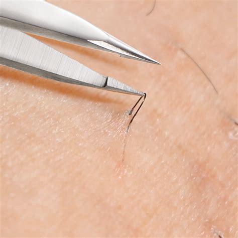 How to Remove Ingrown Hairs Using Pointed Tweezers – DUROX