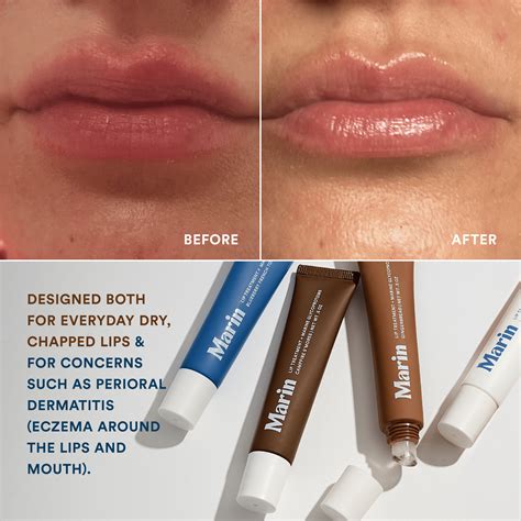 Lip Treatment - Marine Glycoprotein-Powered to Hydrate, Soothe & Repair ...