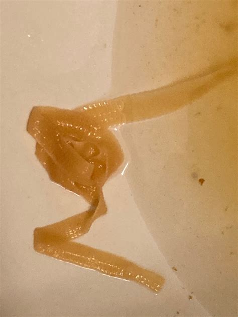 Long Strings In Poop